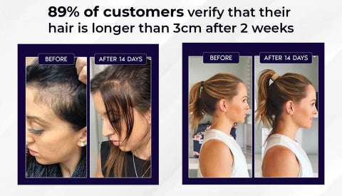 🌿 HZA™ Natural Hair Regrowth Spray – 70% OFF Ends Tonight!