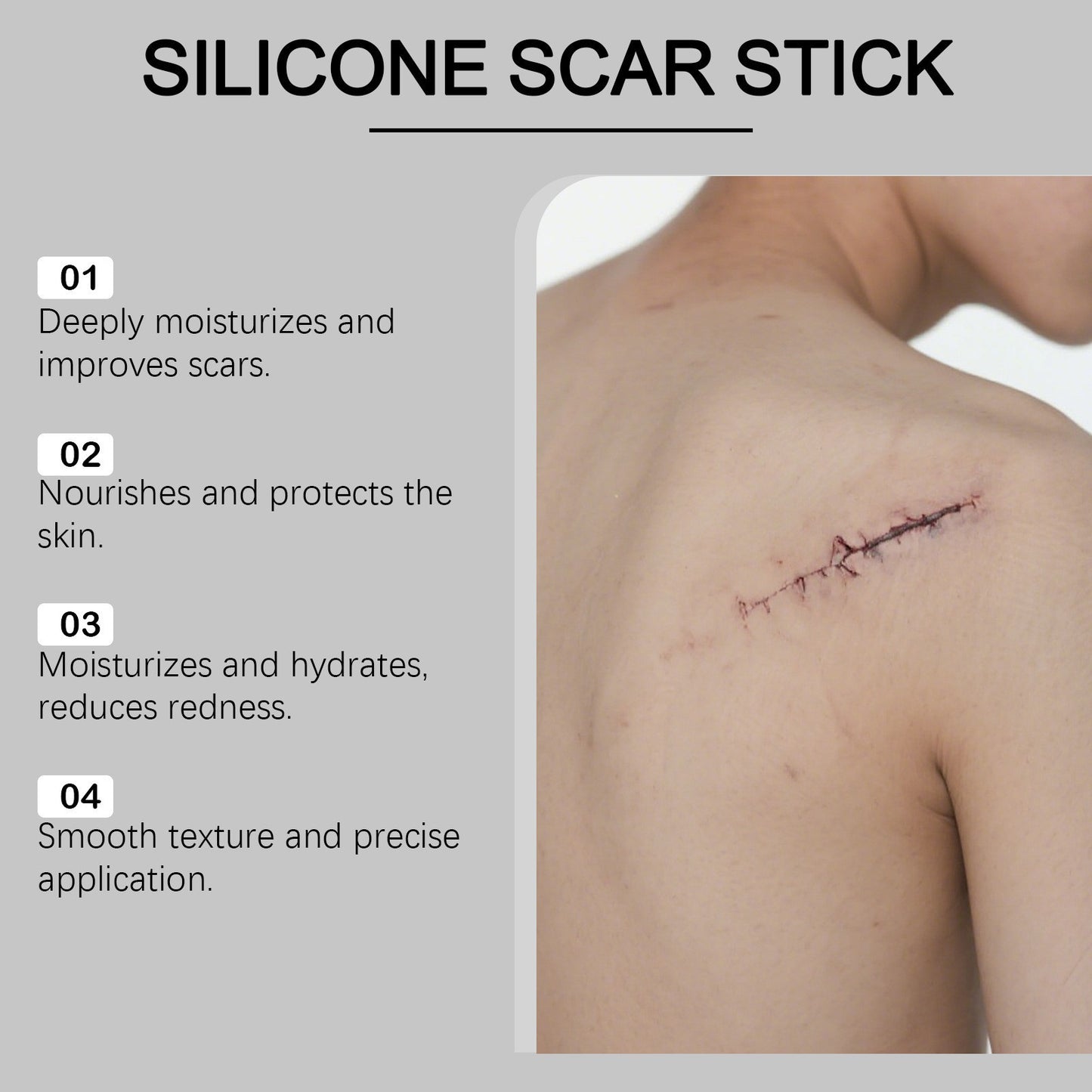 🌿 LOVILDS Silicone Scar Stick