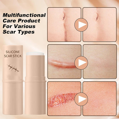 🌿 LOVILDS Silicone Scar Stick