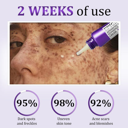𝐋𝐎𝐕𝐈𝐋𝐃𝐒™ 𝐄𝐏𝐈𝐆𝐋𝐎𝐖 𝐀𝐝𝐯𝐚𝐧𝐜𝐞𝐝 𝐂𝐫𝐞𝐚𝐦 – Clinically designed to correct skin pigmentation