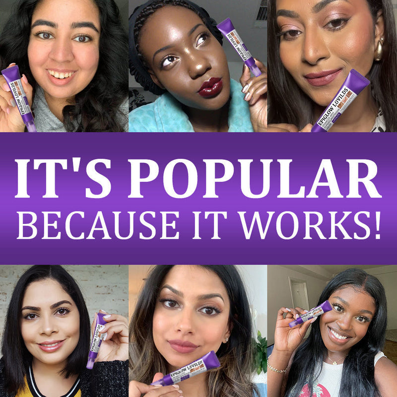 𝐋𝐎𝐕𝐈𝐋𝐃𝐒™ 𝐄𝐏𝐈𝐆𝐋𝐎𝐖 𝐀𝐝𝐯𝐚𝐧𝐜𝐞𝐝 𝐂𝐫𝐞𝐚𝐦 – Clinically designed to correct skin pigmentation