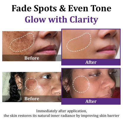 𝐋𝐎𝐕𝐈𝐋𝐃𝐒™ 𝐄𝐏𝐈𝐆𝐋𝐎𝐖 𝐀𝐝𝐯𝐚𝐧𝐜𝐞𝐝 𝐂𝐫𝐞𝐚𝐦 – Clinically designed to correct skin pigmentation