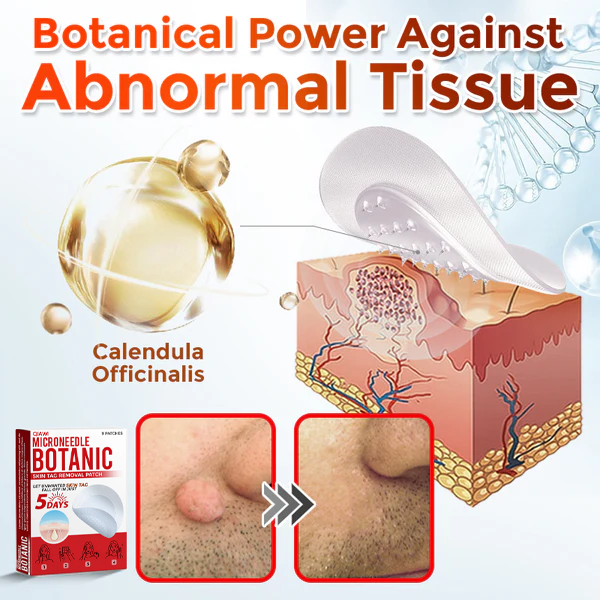 👨‍⚕️QIAWI® MicroNeedle Skin Tag Removal Patches – Fast, Painless & Plant-Powered Formula Backed by Dermatologists