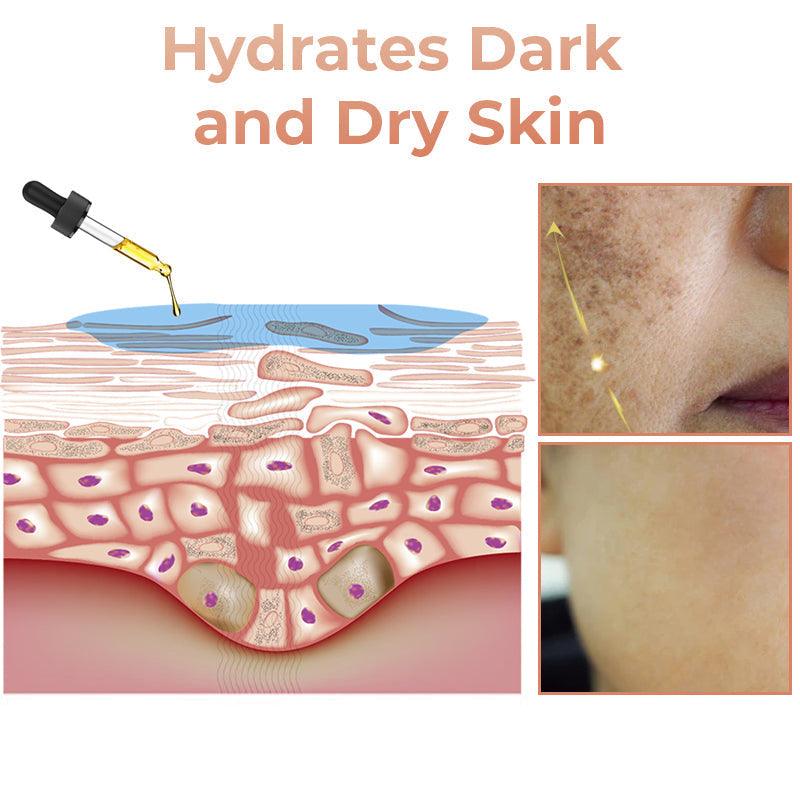 ✨Last Day Discount: 87%OFF-LOVILDS™  Remove freckle Facial Serum