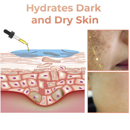 ✨Last Day Discount: 87%OFF-LOVILDS™  Remove freckle Facial Serum