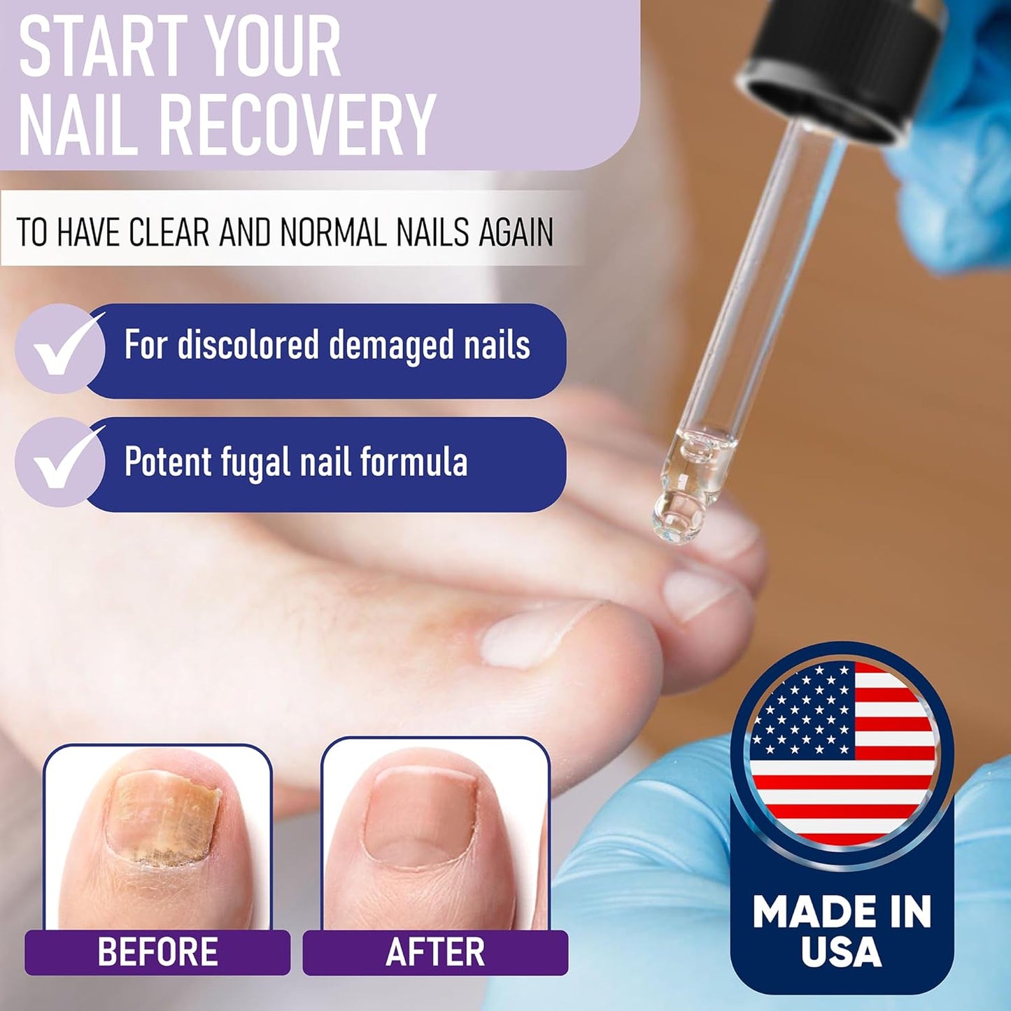 "From Brittle to Beautiful – Let Your Nails Thrive with BBOJI™