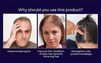 🌿 HZA™ Natural Hair Regrowth Spray – 70% OFF Ends Tonight!