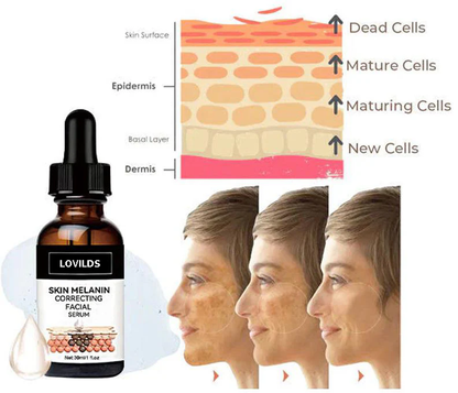 ✨Last Day Discount: 87%OFF-LOVILDS™  Remove freckle Facial Serum