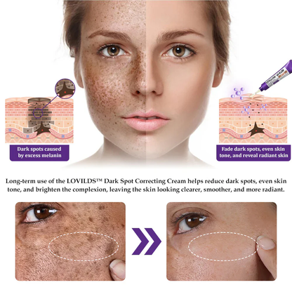 𝐋𝐎𝐕𝐈𝐋𝐃𝐒™ 𝐄𝐏𝐈𝐆𝐋𝐎𝐖 𝐀𝐝𝐯𝐚𝐧𝐜𝐞𝐝 𝐂𝐫𝐞𝐚𝐦 – Clinically designed to correct skin pigmentation
