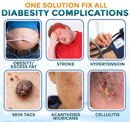 🧬 flysmus® Metformin Nodular Acupoint Stimulating Patch 🧑‍⚕️ Treats Diabesity, Obesity, High Blood Sugar Level