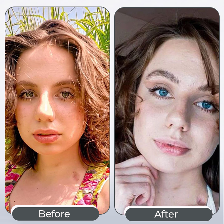 𝑨𝑸𝑨™ 𝑺𝒑𝒆𝒄𝒕𝒓𝒂𝑬𝒚𝒆 𝑪𝒐𝒍𝒐𝒓 𝑪𝒉𝒂𝒏𝒈𝒊𝒏𝒈 𝑫𝒓𝒐𝒑𝒔 𝑷𝒓𝒐 （👁️ Clinically Tested & Ophthalmologist Approved）（副本）