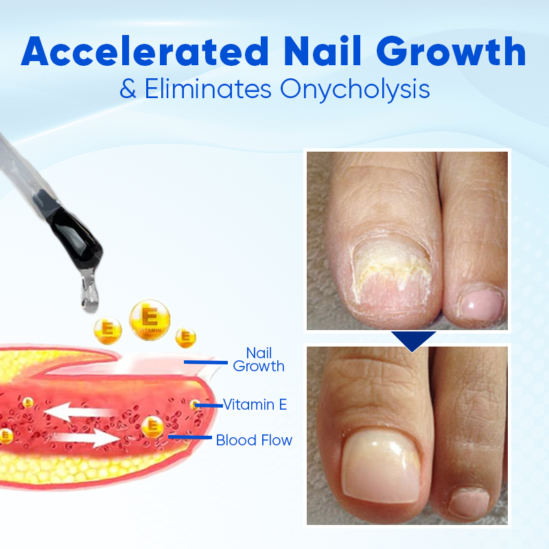 "From Brittle to Beautiful – Let Your Nails Thrive with BBOJI™