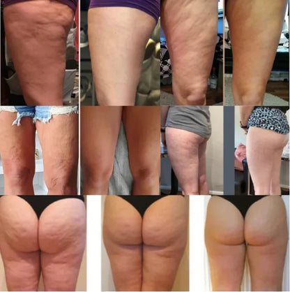 🏅 Clinically Tested &amp; Dermatologist-Recommended  Vaxflite™ Anti-Cellulite Massage Oil