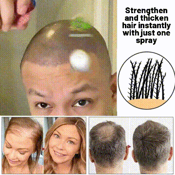 🌿 HZA™ Natural Hair Regrowth Spray – 70% OFF Ends Tonight!